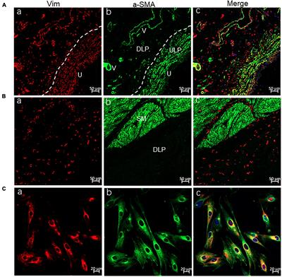 Functional Expression of Transient Receptor Potential and Piezo1 Channels in Cultured Interstitial Cells of Human-Bladder Lamina Propria